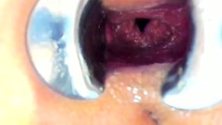 Amateur Webcam Anal Masturbation