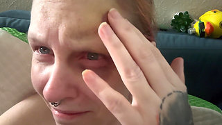 Hurting My Own Bruise