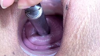 Cervix and Pee Hole Inflation with Injections for Japan Lesb